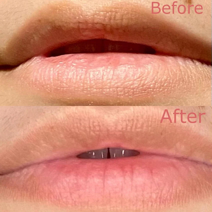Patchology Served Chilled Rose Lip Gel