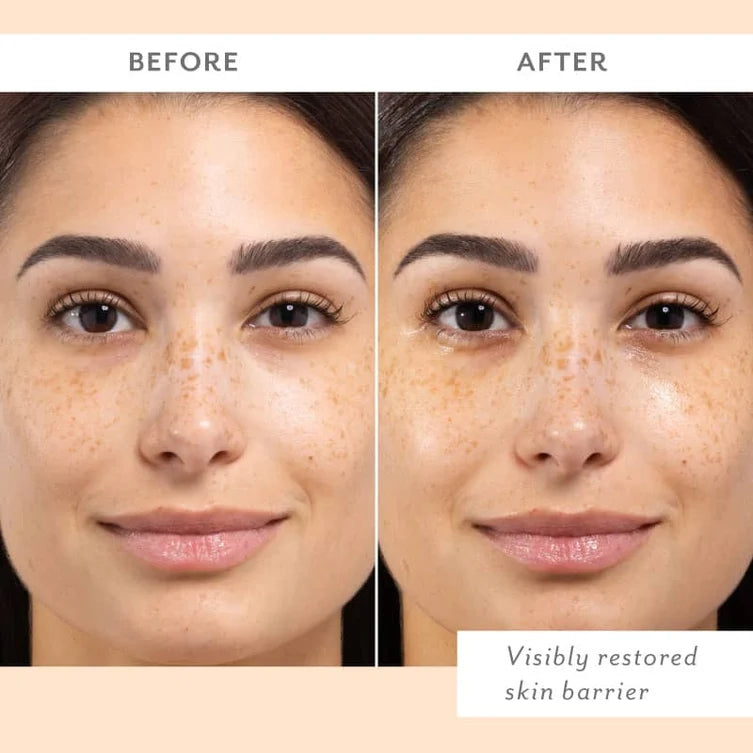 Patchology Skin Remedy Calm & Protect Mist